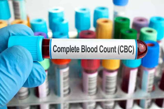 Complete Blood Count Test