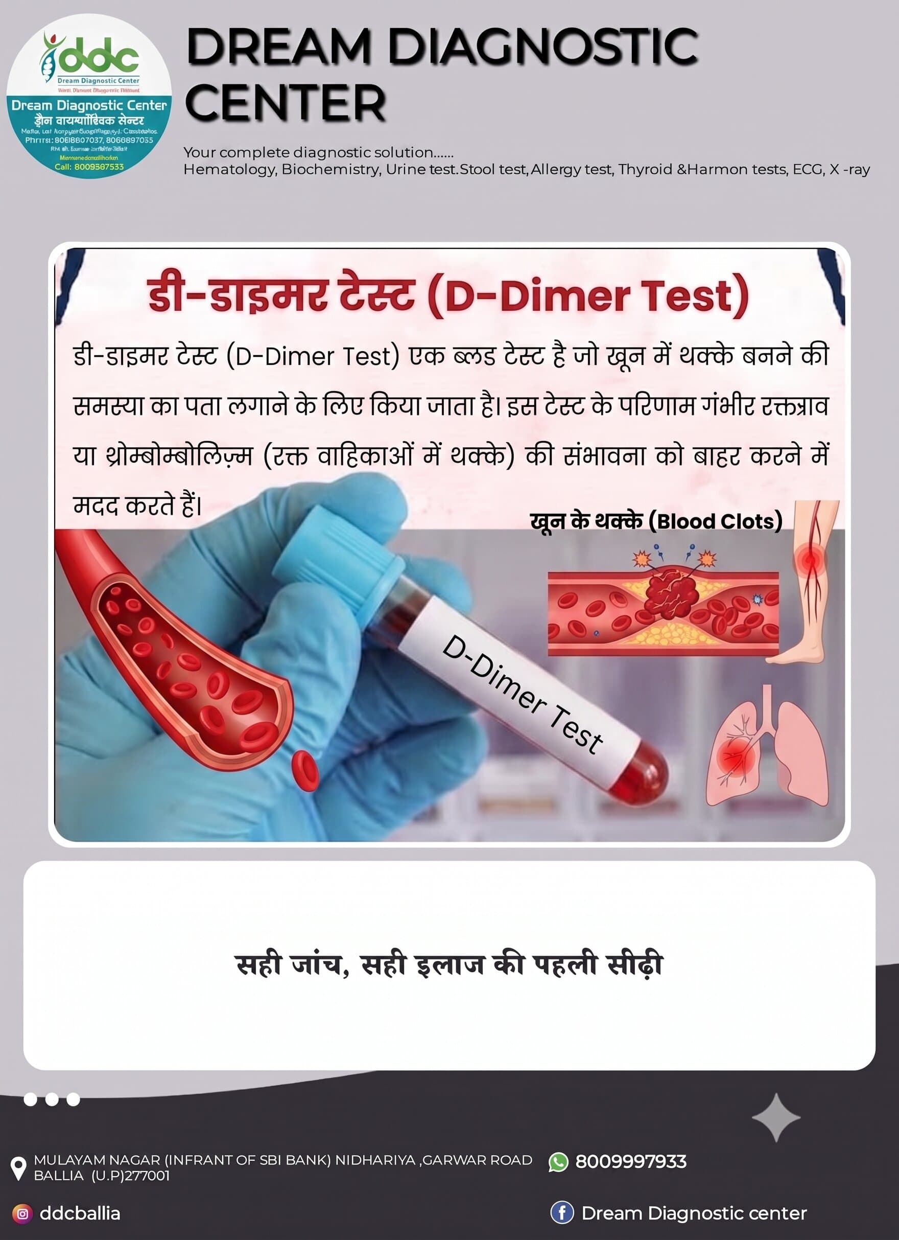 D-Dimer Test