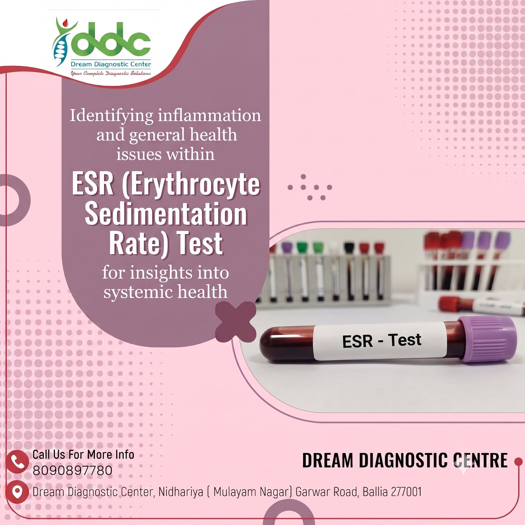 ESR Test