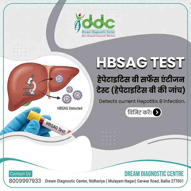 HBsAg Test