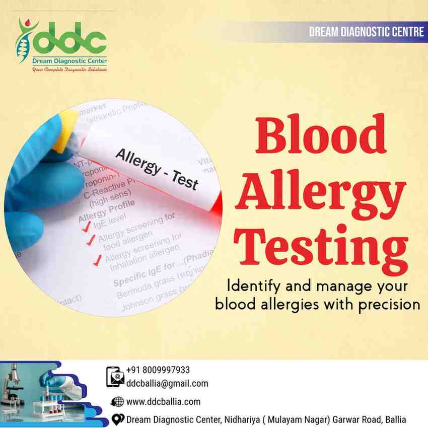 Immunoglobulin E Test