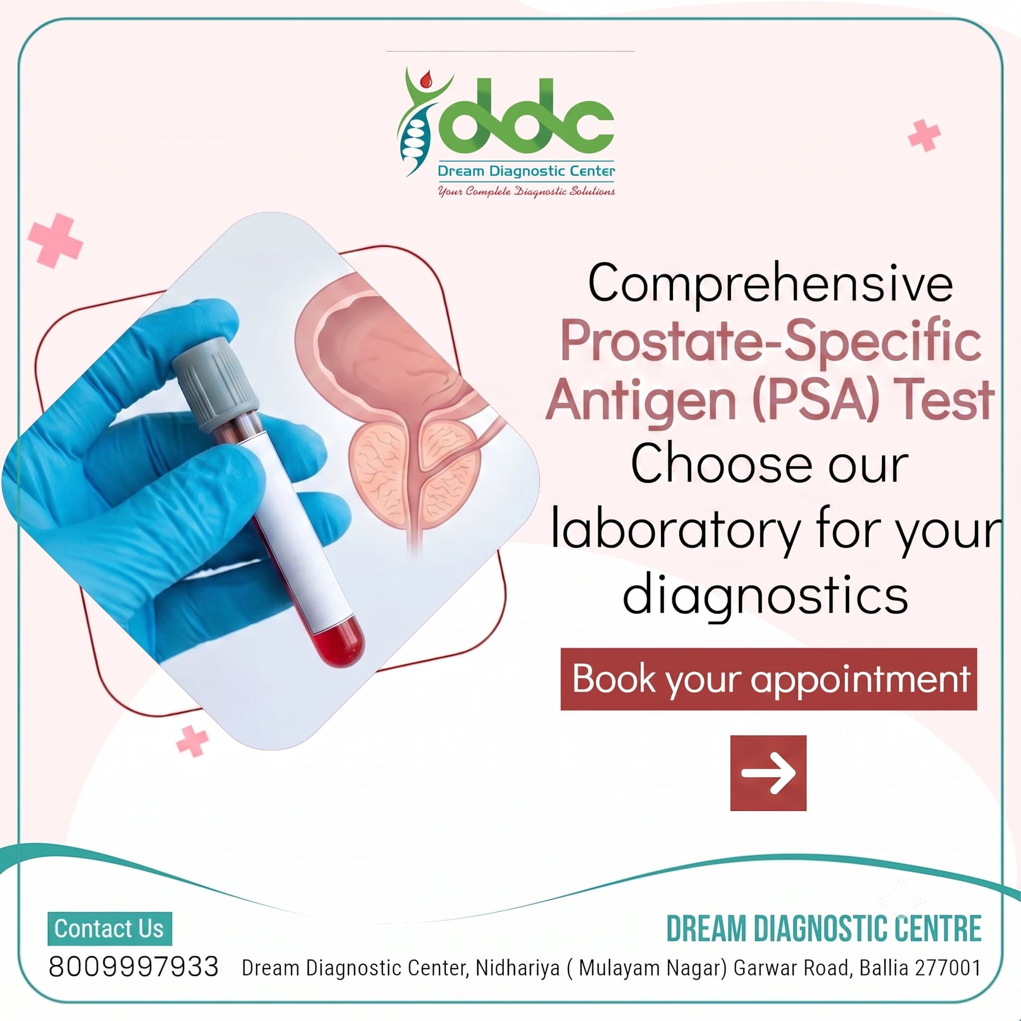 Prostate Specific Antigen Test