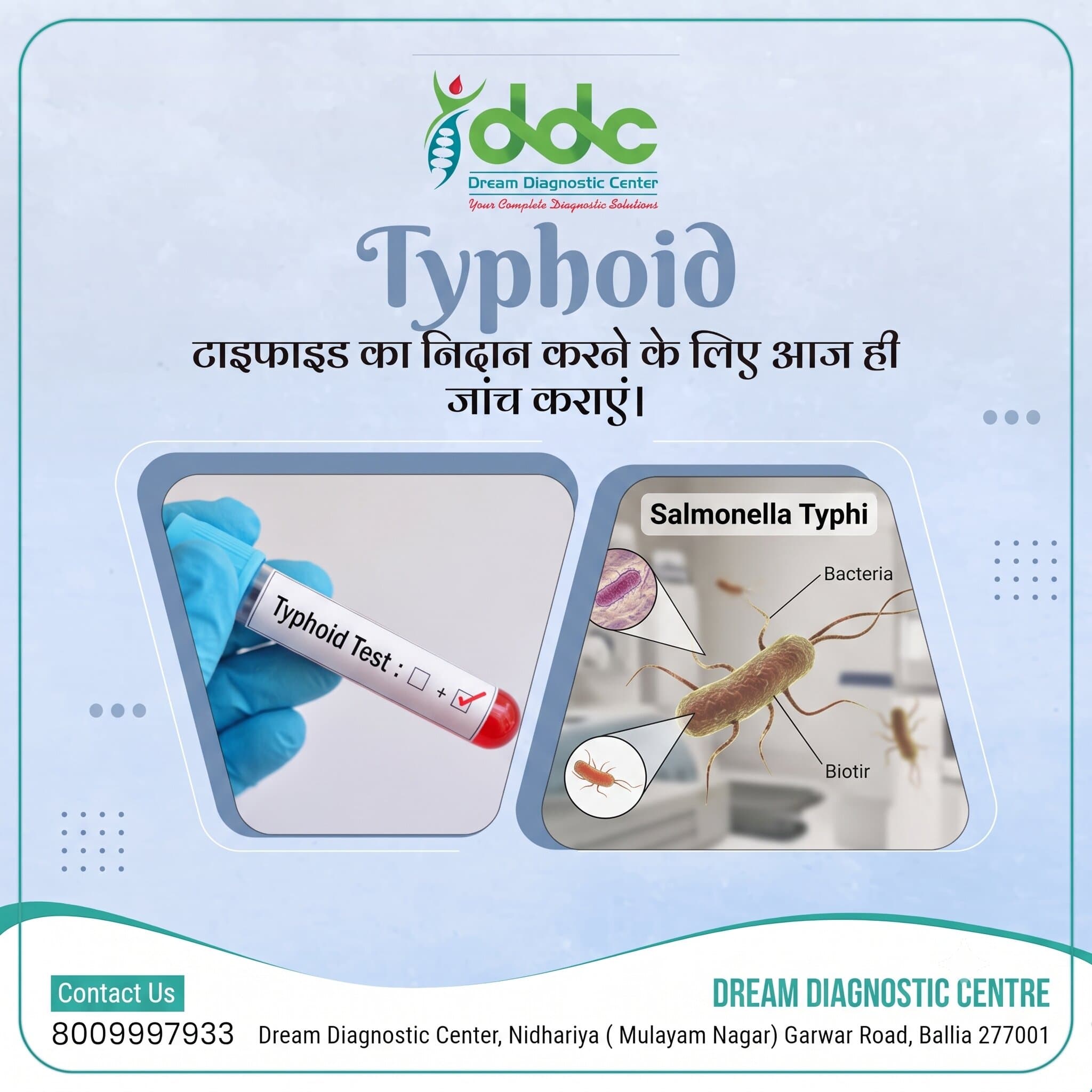 Typhoid IgM Test