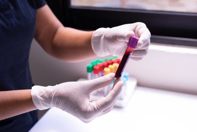 Vitamin D3 Hydroxy Test